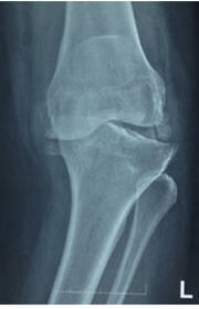 Specialization Specialization